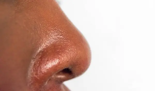 closeup-oily-skin-on-nose