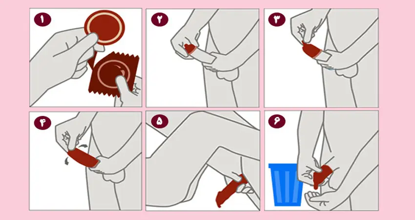 نحوه پوشیدن کاندوم