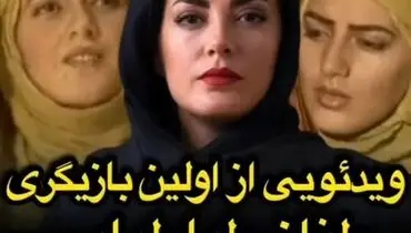 چهره قبل عمل و اولین تجربه بازیگری طناز طبابایی+ ویدیو