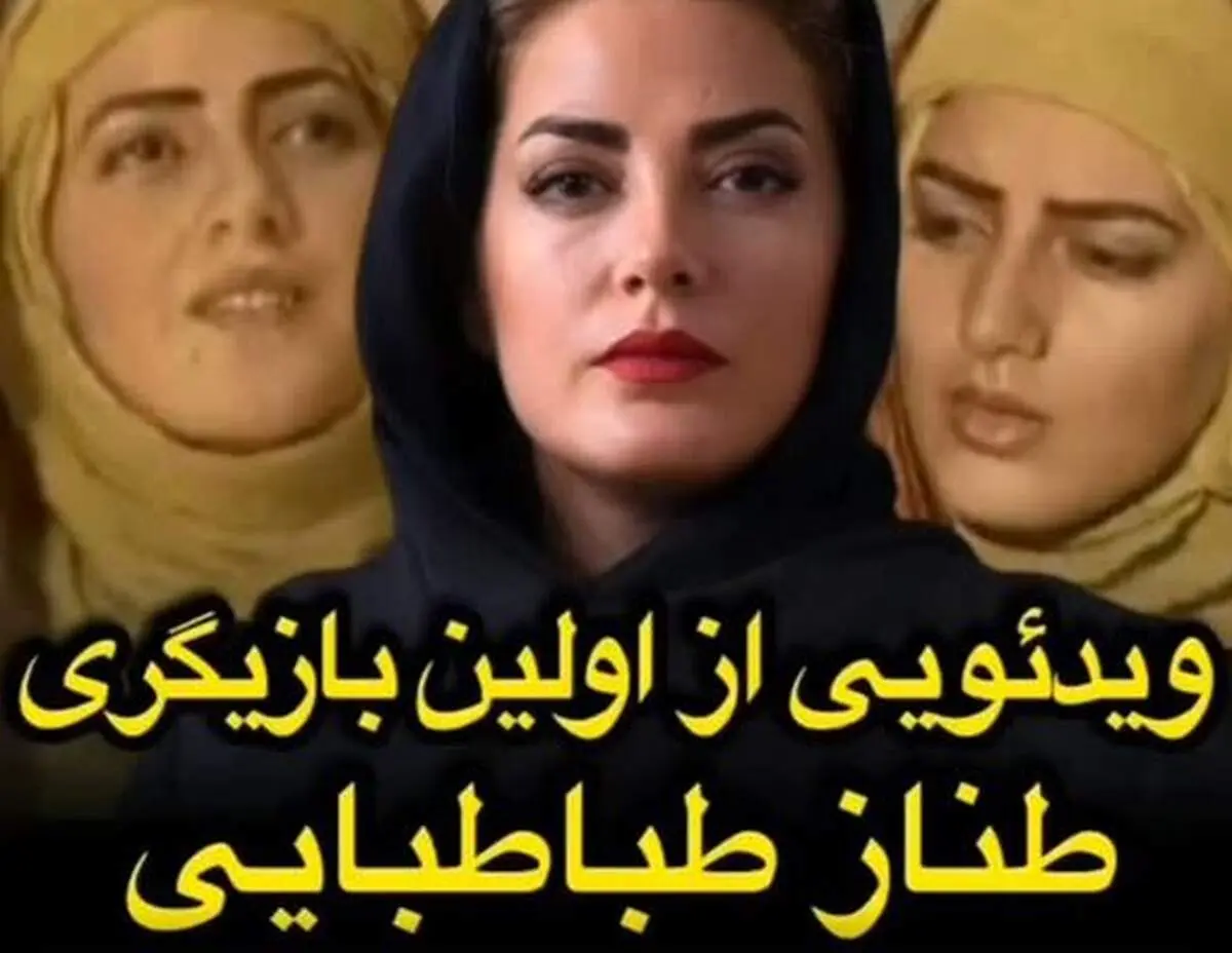 چهره قبل عمل و اولین تجربه بازیگری طناز طبابایی+ ویدیو