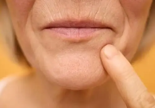 کلاژن و ژلاتین چه تفاوتی دارند؟