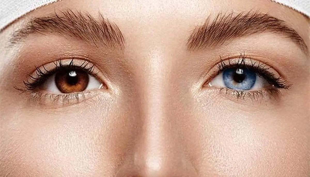 رقم های عجیب و غریب برای عمل تغییر رنگ چشم