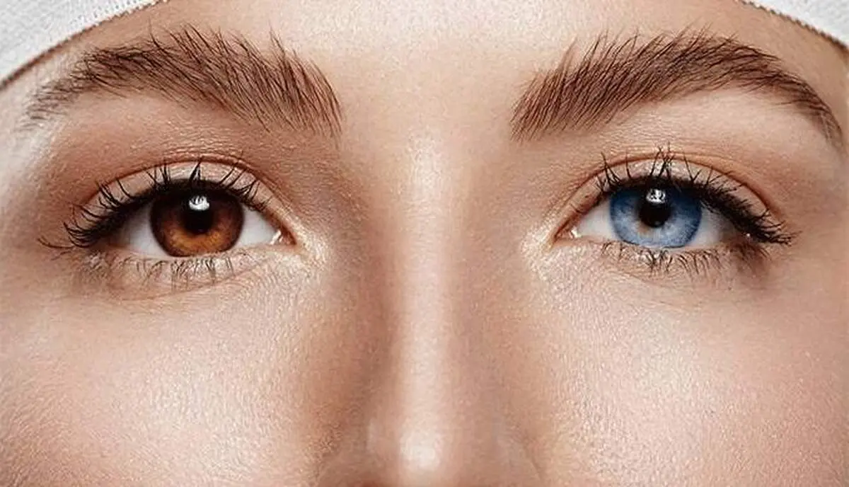 رقم‌ های عجیب و غریب برای عمل تغییر رنگ چشم