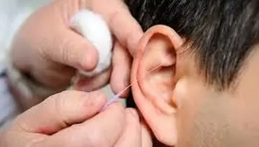 علل سوت کشیدن گوش چیست؟
