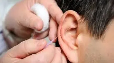 علل سوت کشیدن گوش چیست؟
