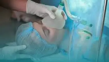 علت به هوش نیامدن بعد از عمل بینی چیست؟
