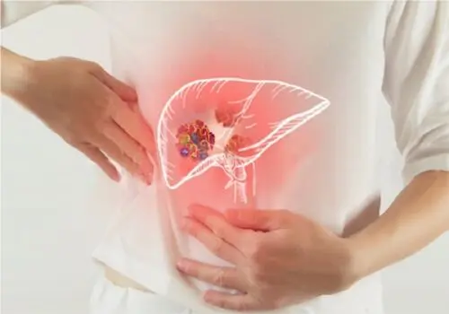 مهمترین راهکار رهایی از شر کبد چرب