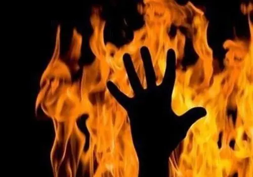 اقدامات ضروری در مواجهه با سوختگی