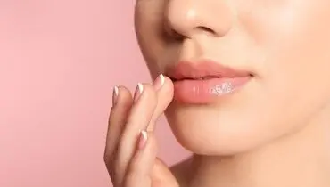مراقبت های ضروری بعد از تزریق ژل لب