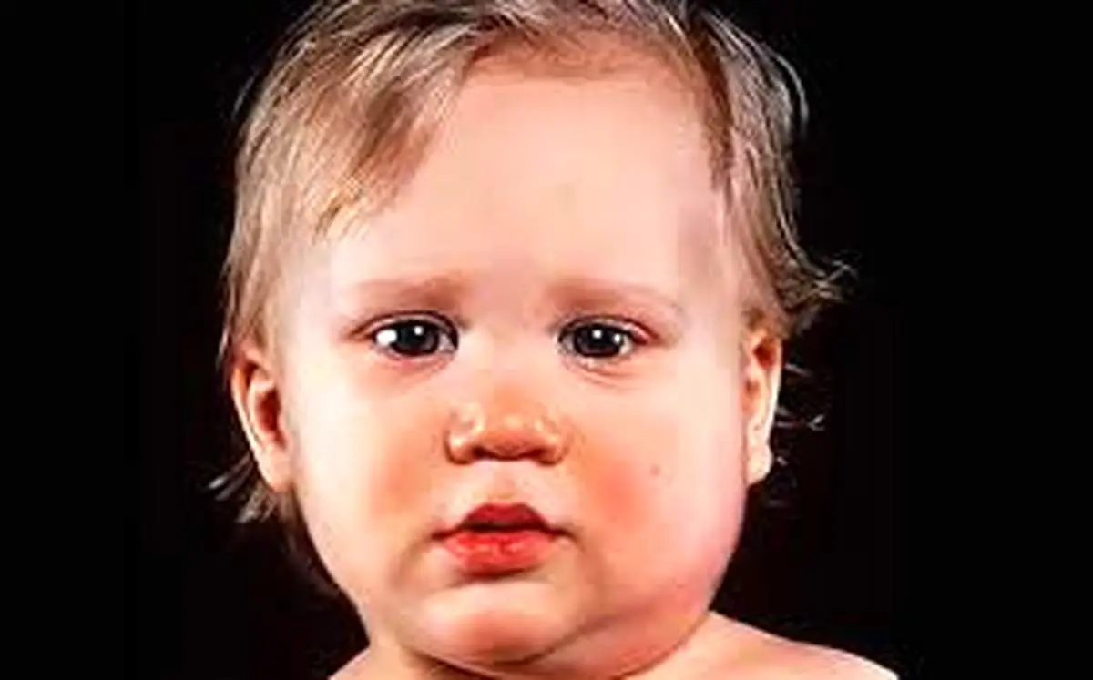 اوریون چیست و چرا دچار اوریون می شویم؟
