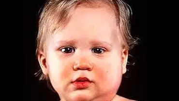 اوریون چیست و چرا دچار اوریون می شویم؟
