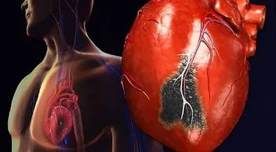 شناخت انواع درد قلب و اهمیت تشخیص سریع آن‌ها