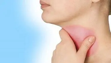 رژیم غذایی مفید برای مبتلایان به کم کاری تیروئید