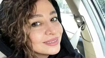 چهره جدید مهلقا باقری: تغییرات جنجالی پس از عمل زیبایی!