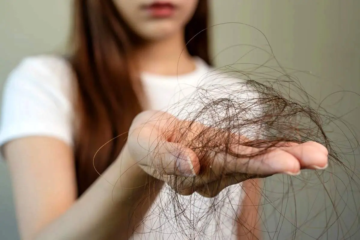 مصرف این خوراکی ها برای جلوگیری از ریزش مو الزامی است