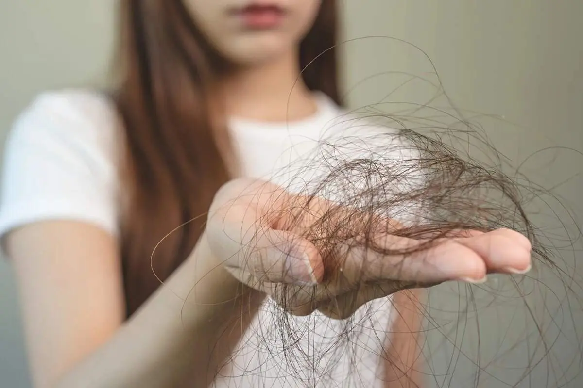 مصرف این خوراکی ها برای جلوگیری از ریزش مو الزامی است