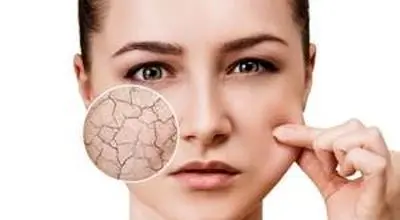  عواملی که باعث نابودی پوست می شود!