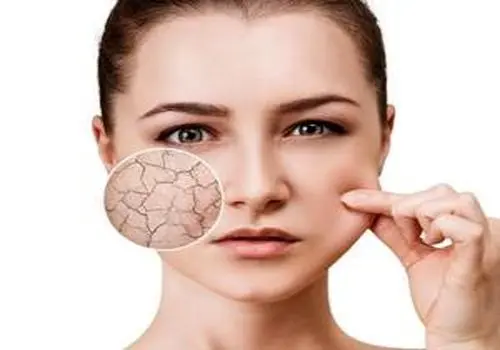 ترمیم موهای سوخته با رنگ و دکلره