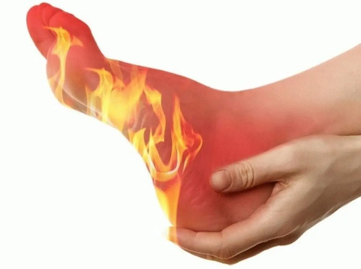 داغی کف پا در شب نشانه ابتلا به این بیماری است
