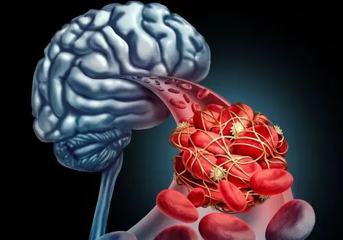 تغذیه مناسب برای افراد کم‌تحرک: راهکارهایی برای حفظ سلامتی در سبک زندگی نشسته!