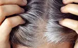خبر خوب برای موهای سفید؛ شاید درمانی در راه باشد خبر خوب برای موهای سفید؛ شاید درمانی در راه باشد