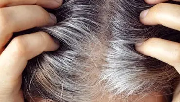 خبر خوب برای موهای سفید؛ شاید درمانی در راه باشد