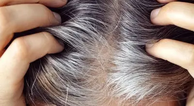 خبر خوب برای موهای سفید؛ شاید درمانی در راه باشد
