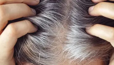 خبر خوب برای موهای سفید؛ شاید درمانی در راه باشد