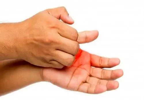 دلایل تجمع مایع پشت پرده گوش
