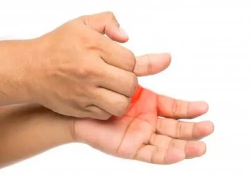 دلایل تجمع مایع پشت پرده گوش
