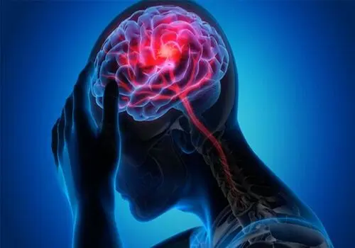  چگونه علائم سکته مغزی را به موقع شناسایی کنیم؟