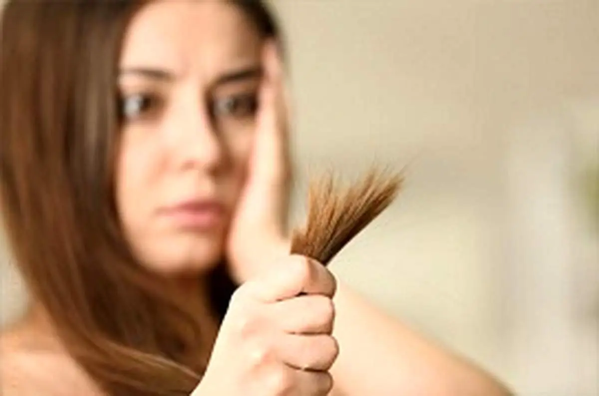 چطور از موخوره پیشگیری کنیم؟ | راز موهای درخشنده و با طراوت با این چند روش ساده