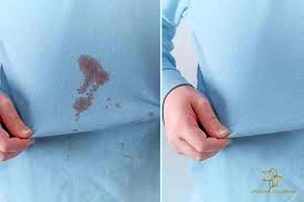 پاک کردن لکه‌های چربی از روی لباس