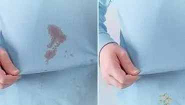 پاک کردن لکه‌های چربی از روی لباس