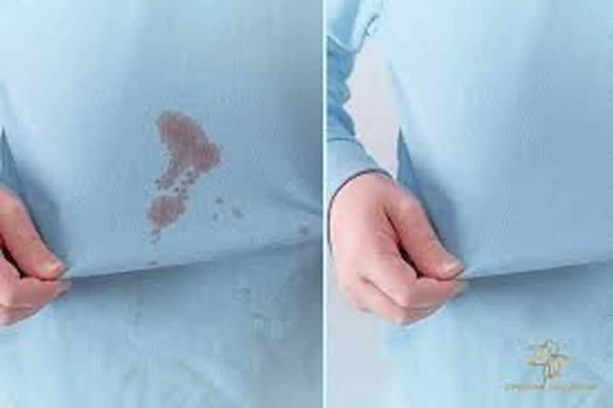 پاک کردن لکه‌های چربی از روی لباس