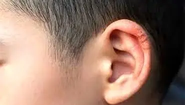 ۳ نشانه و روش درمان قطعی خارش و خشکی لاله گوش در چیست؟