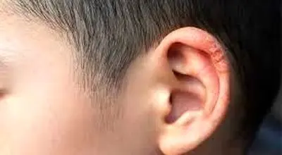 ۳ نشانه و روش درمان قطعی خارش و خشکی لاله گوش در چیست؟