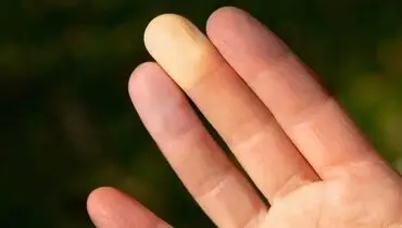 حال روحی‌تان را از روی نوک انگشتان‌تان بررسی کنید