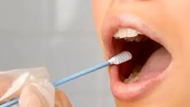 
۳ ترفند برای درمان تلخی دهان!
