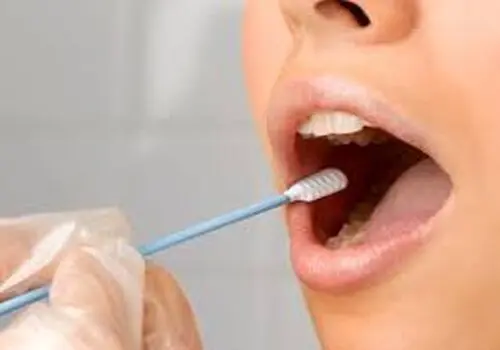 علت مهم آبریزش دهان روی بالش نشانه 