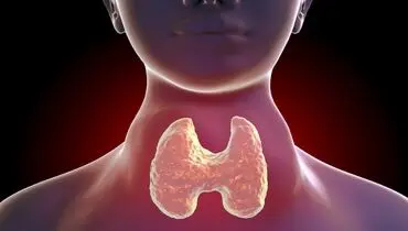 چگونه کمبود ید را برای حفظ سلامت تیروئید جبران کنیم؟