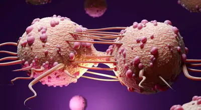 هشدار رشد ابتلا به سرطان پستان در ایران