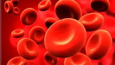 کمبود آهن با این علائم بروز میکند