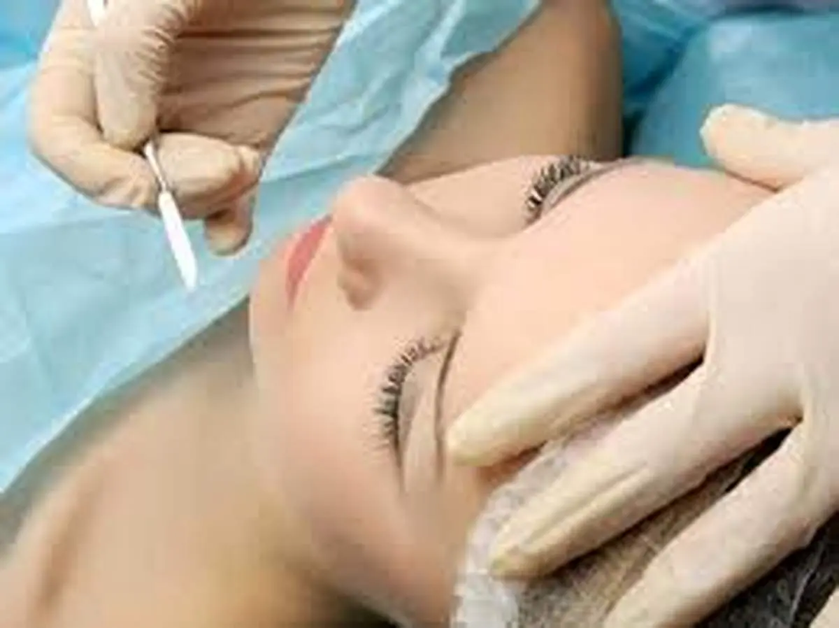 اهمیت سن در عمل بینی و چرایی آن