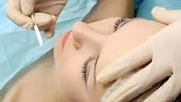 اهمیت سن در عمل بینی و چرایی آن