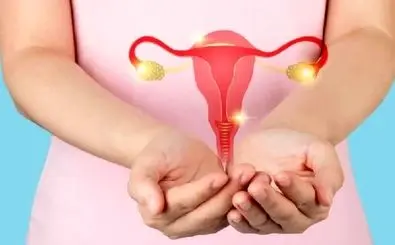 این علائم از تخمدان پلی کیستیک خبر میدهند