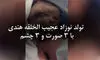 تولد نوزاد عجیب الخلقه هندی با ۳ صورت و ۳ چشم/ویدیو