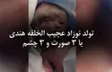 تولد نوزاد عجیب الخلقه هندی با ۳ صورت و ۳ چشم/ویدیو 