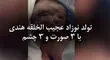 تولد نوزاد عجیب الخلقه هندی با ۳ صورت و ۳ چشم/ویدیو 