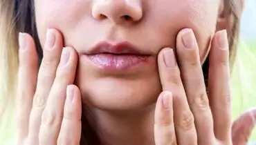 با این ترفند فوری از شر تبخال خلاص شوید!